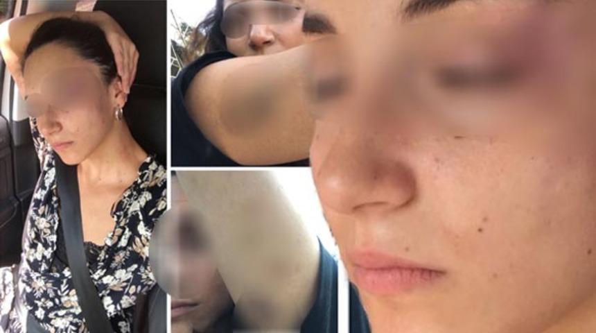 &Uuml;nl&uuml; yalıda dayak rezaleti! 