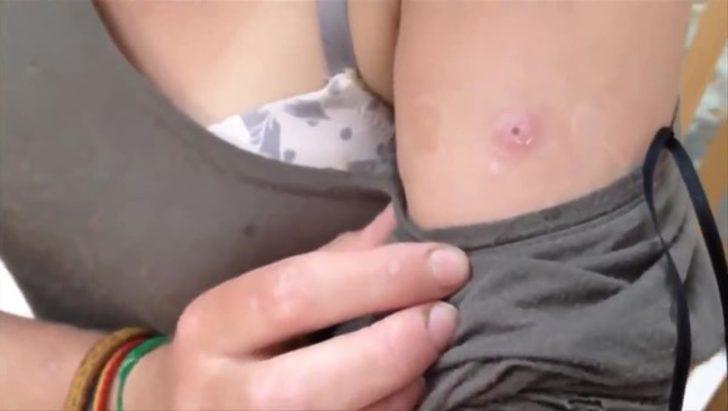 Kolundan çıkanlara inanamadı  G1