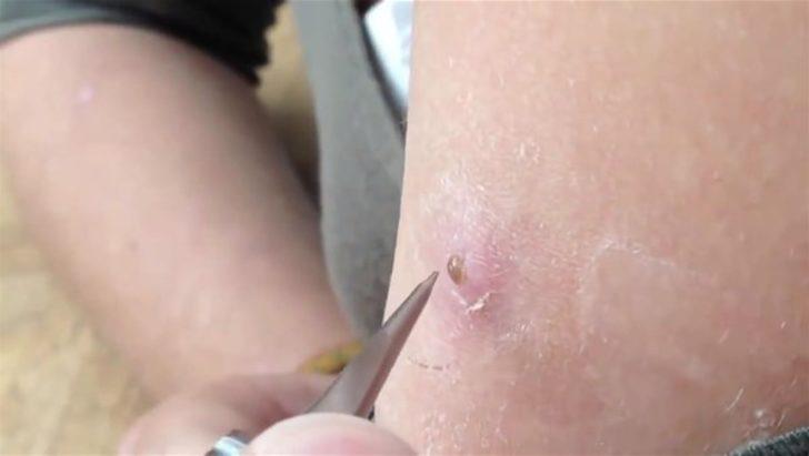 Kolundan çıkanlara inanamadı  G2