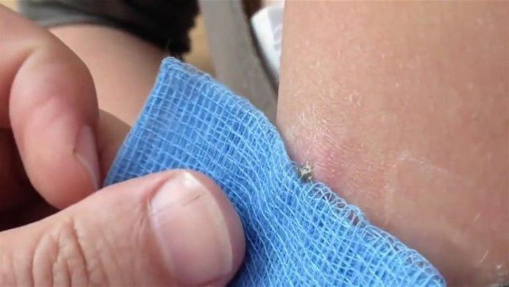 Kolundan çıkanlara inanamadı  G3