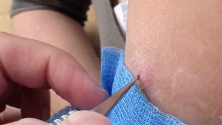 Kolundan çıkanlara inanamadı  G4