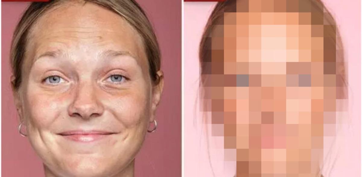 Bir hafta boyunca 3 litre su i&ccedil;ti sonucu karşısında şaşkına d&ouml;nd&uuml;