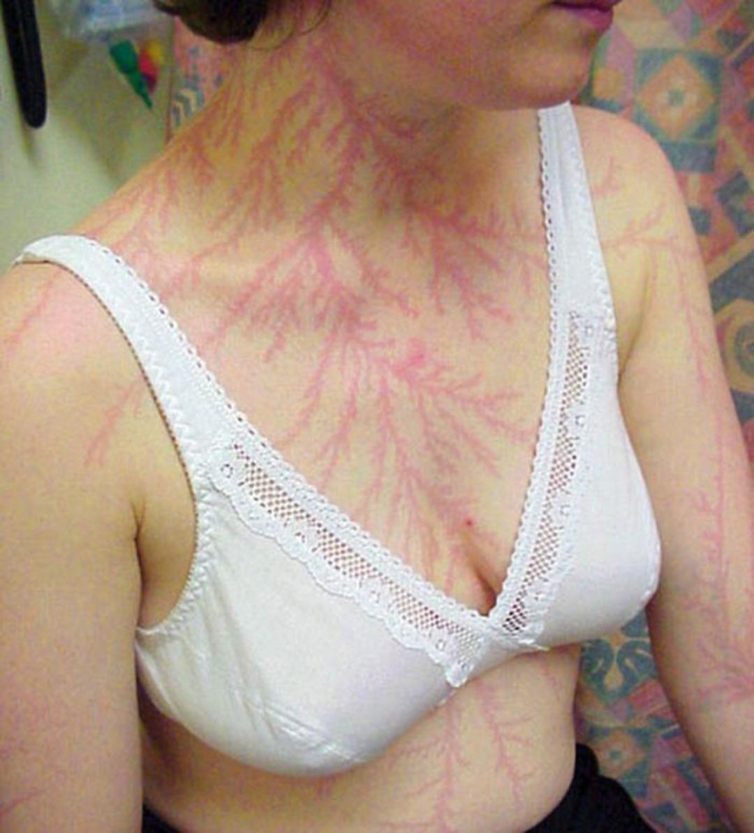 Yıldırım &ccedil;arpmasının izlerini paylaştılar 