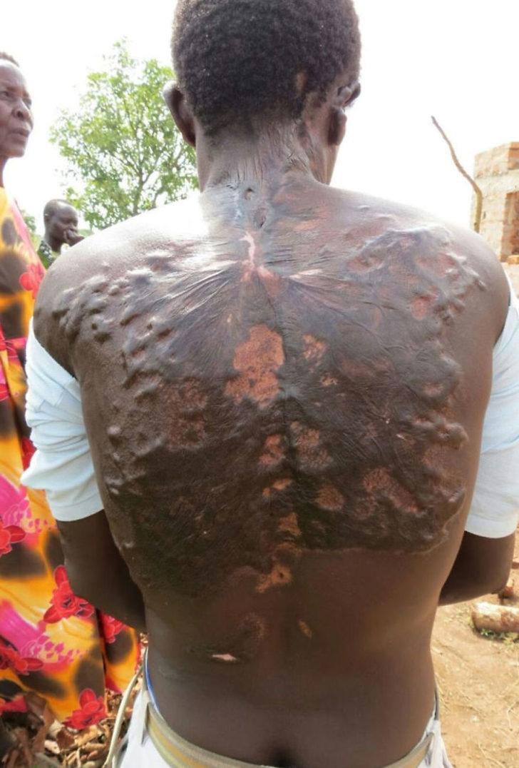 İnanılır gibi değil! Yıldırım çarptı, hayatta kalmayı başardı ama... G3