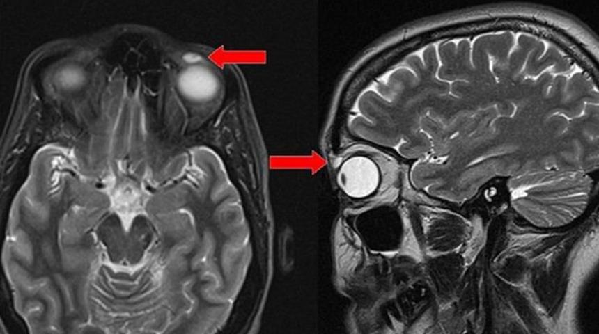 Doktorlar şok oldu! 28 yıl boyunca böyle yaşamış