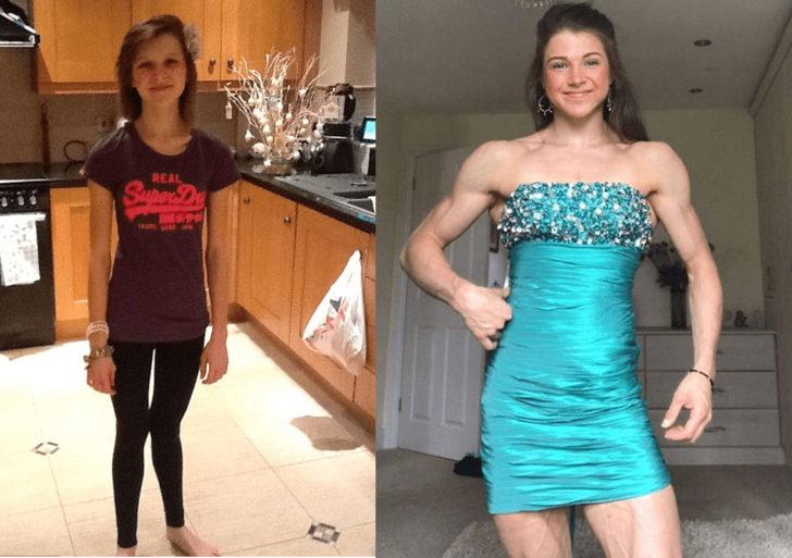 Anoreksiya hastası genç kız ölümden döndü!  G2