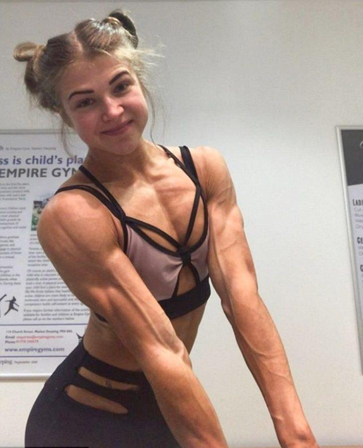 Anoreksiya hastası genç kız ölümden döndü!  G4