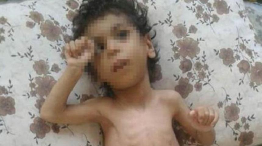 Kedi-k&ouml;pek eti k&uuml;&ccedil;&uuml;k &Ouml;mer Ali hastaneye kaldırıldı!