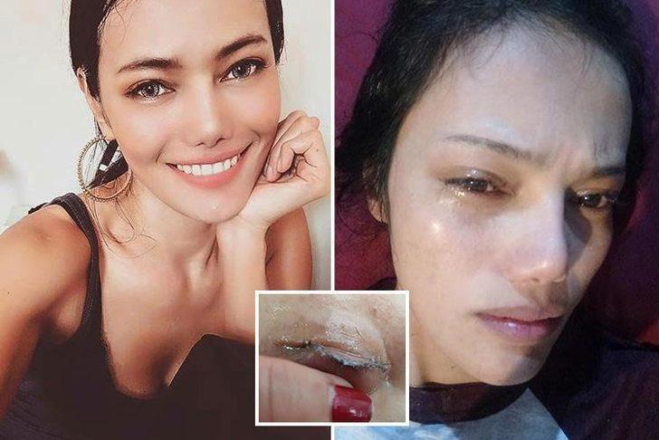 Güzelleşmek isterken kirpiklerinden oldu! G1