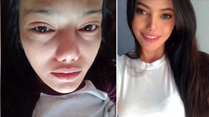 Güzelleşmek isterken kirpiklerinden oldu! G2