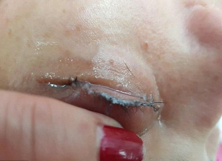 Güzelleşmek isterken kirpiklerinden oldu! G3