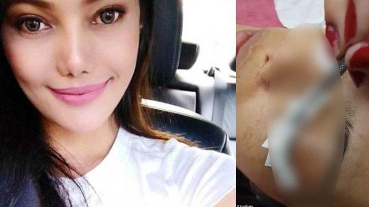 Güzelleşmek isterken kirpiklerinden oldu! G4