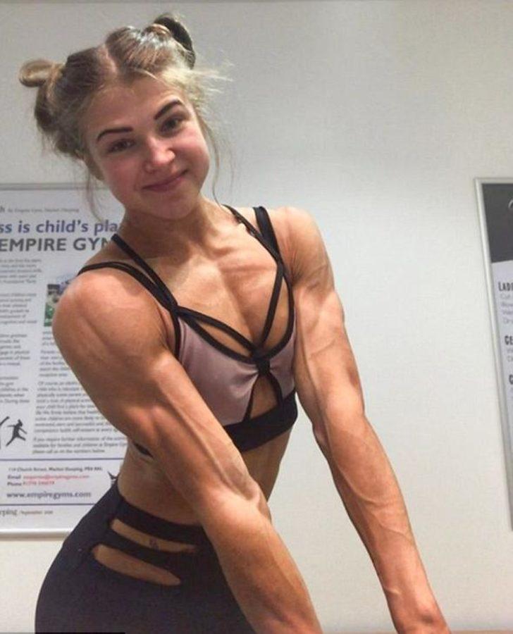 Anoreksiya hastasıydı, vücut geliştirme şampiyonu oldu!  G4