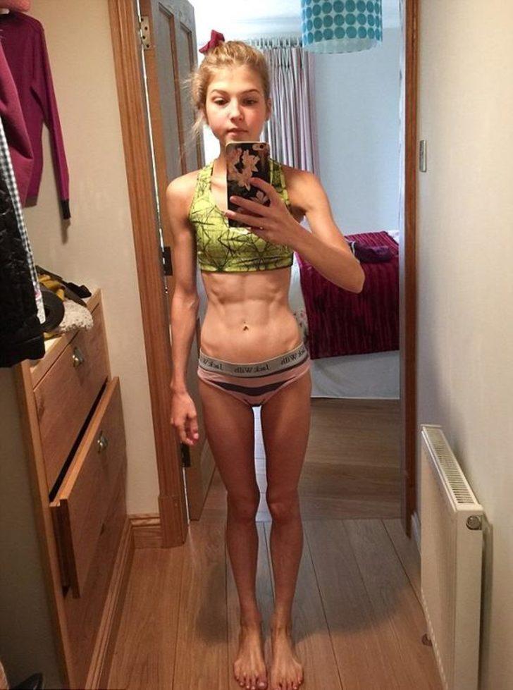 Anoreksiya hastasıydı, vücut geliştirme şampiyonu oldu!  G5