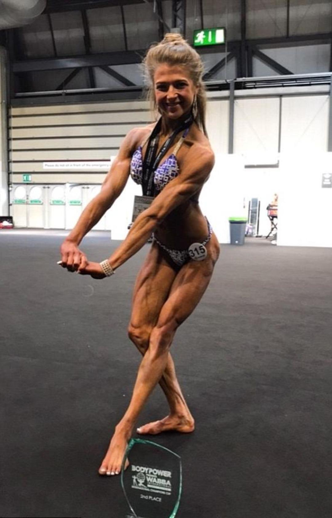 Anoreksiya hastasıydı, v&uuml;cut geliştirme şampiyonu oldu! 