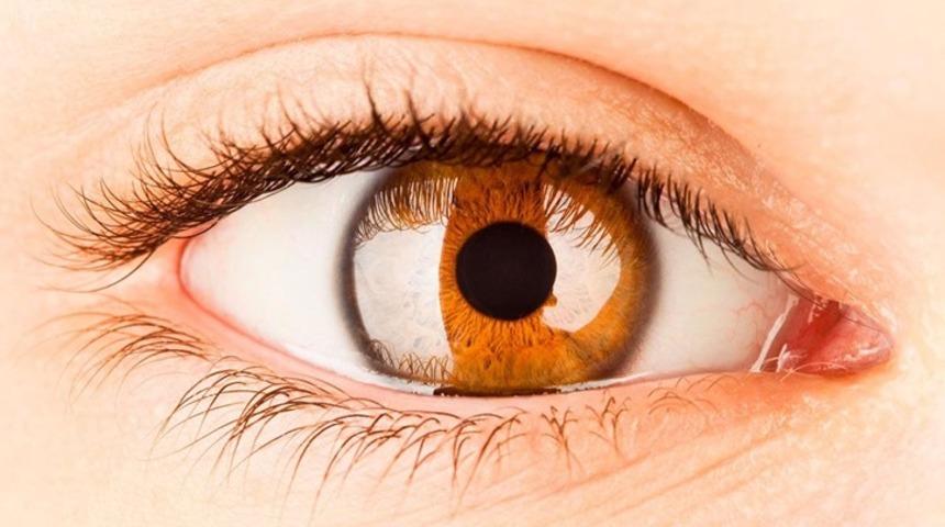 Korneal dövme nasıl yapılır? Korneal dövme sağlık sorunlarına çare oluyor