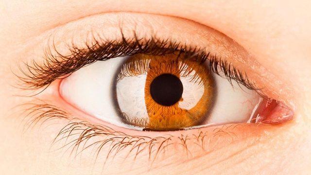 Korneal dövme nasıl yapılır? Korneal dövme sağlık sorunlarına çare oluyor