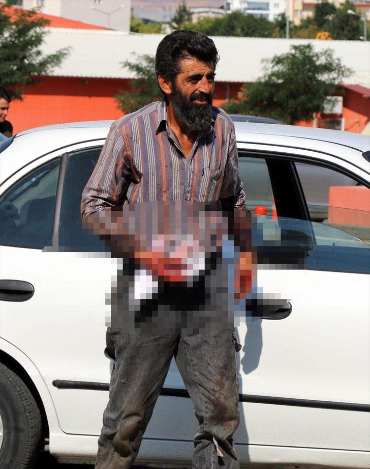 'Acemi kasaplar' hastanelik oldu G3