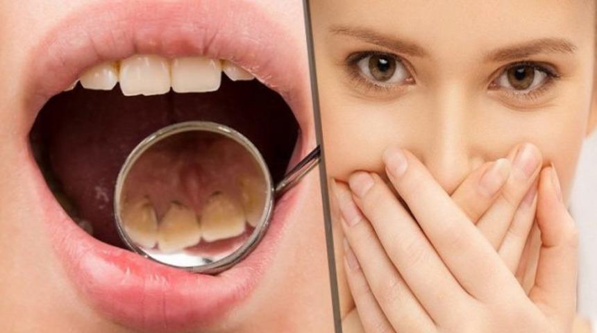 Ağız kokusunu yok eden 6 y&ouml;ntem