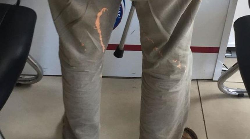 Tuvalet görevlisi üstüne çamaşır suyu döktü!