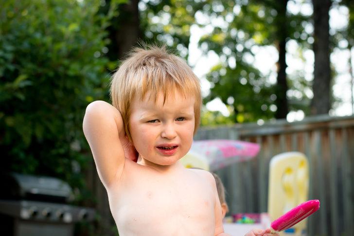 Böcek sokmasına ne iyi gelir? İhmal etmeyin hayatı tehdit ediyor G3