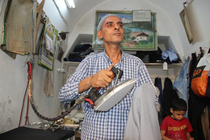 Kafasında 30 çivi, onlarca toplu iğneyle yaşıyor! G3