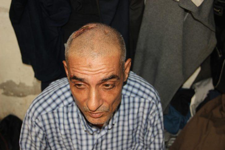 Kafasında 30 çivi, onlarca toplu iğneyle yaşıyor! G5