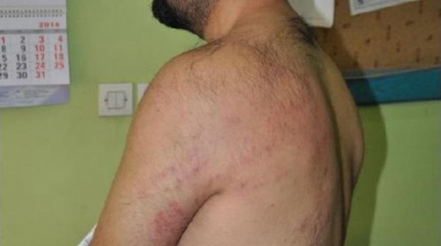 Davutoğlu'nun Mitingi &Ouml;ncesi G&ouml;zaltına Alındı