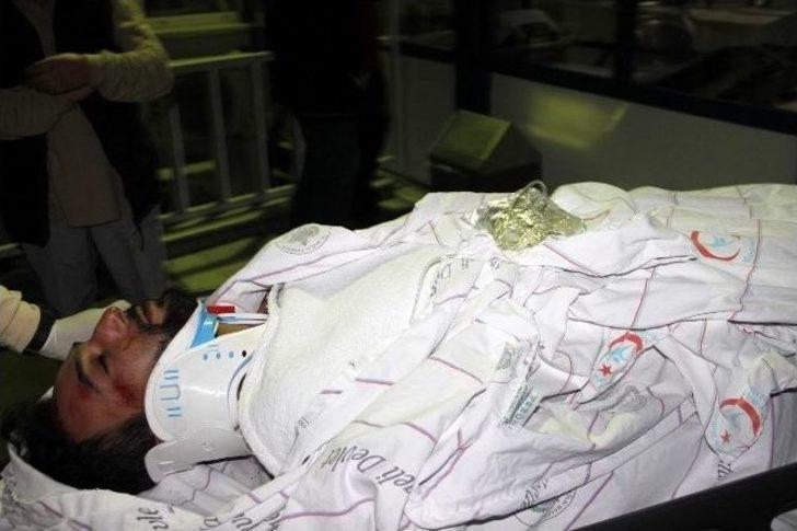 Kazadan Sonra Yanan Otomobilden Sürünerek Çıktılar G1