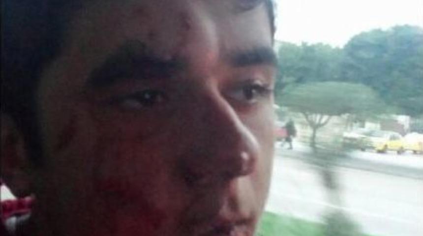 Adana'da '&ouml;calan' Eylemi (2)