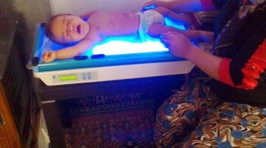 Koşullar Aynı, Fototerapi Cihazı Yeni