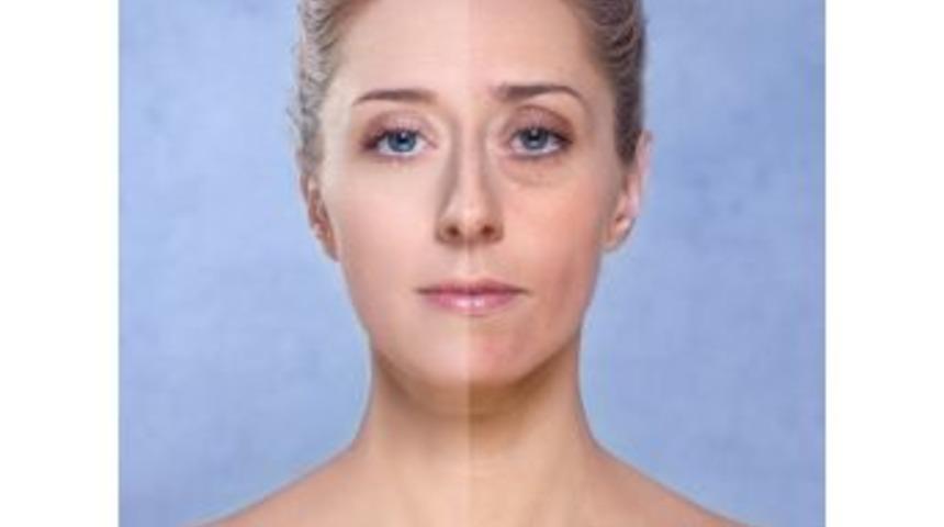 G&ouml;z Altı Torbaları Yaşlı G&ouml;steriyor