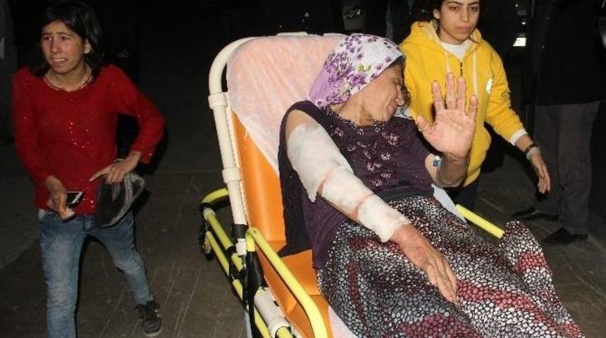 &Uuml;zerine Sıcak Su D&ouml;k&uuml;len Kadın Hastaneye Kaldırıldı