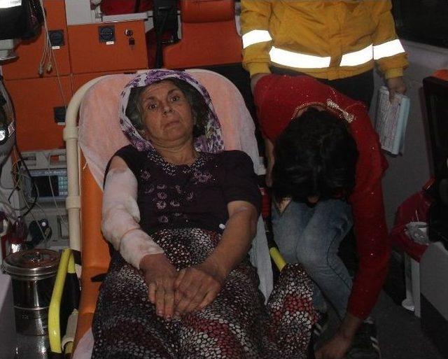 Üzerine Sıcak Su Dökülen Kadın Hastaneye Kaldırıldı