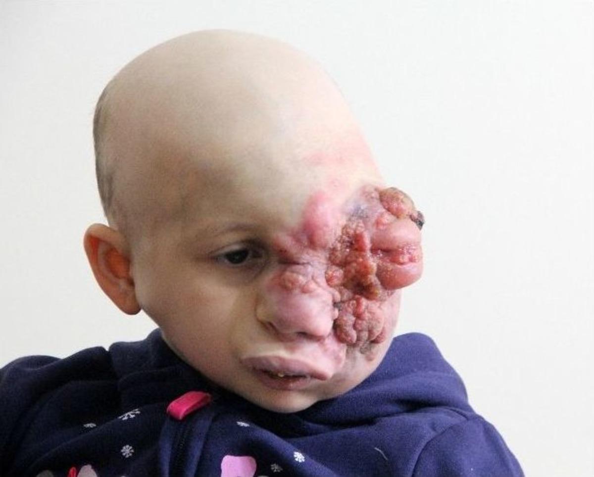 Minik Tuğsem&rsquo;in Ailesi Yardım Bekliyor