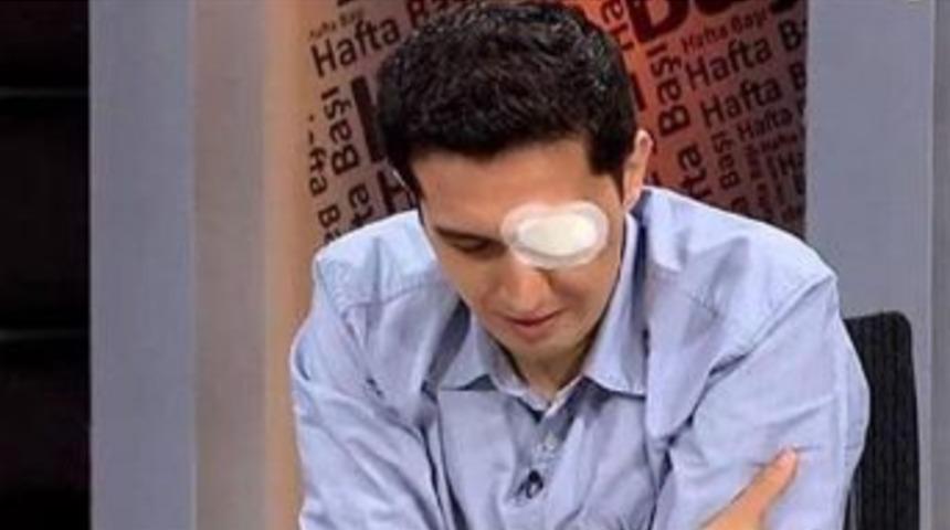 Footage Shows Police Firing Teargas Canisters That Makes Blind Research Assistant