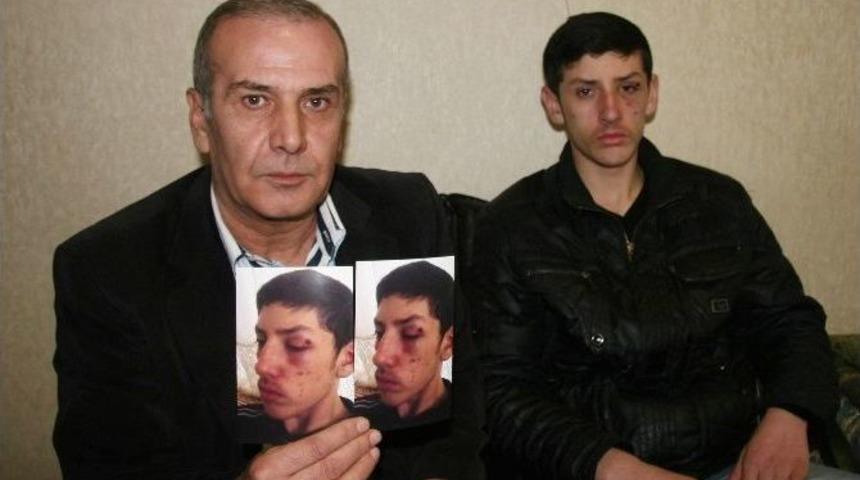 Afyonkarahisar&rsquo;da Okul M&uuml;d&uuml;r&uuml;n&uuml;n &Ouml;ğrenciyi D&ouml;verek Hastanelik Ettiği İddiası