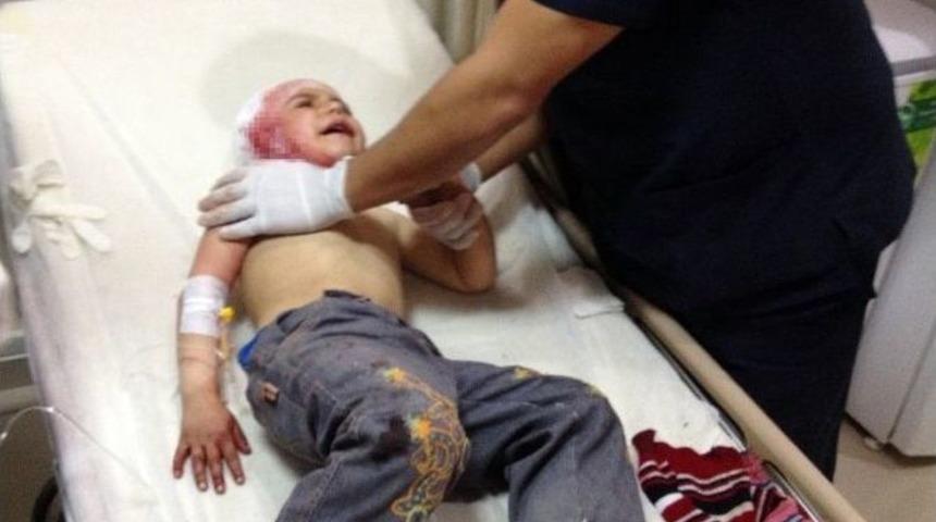 K&ouml;peğin Isırdığı Kız &Ccedil;ocuğu Hastanelik Oldu