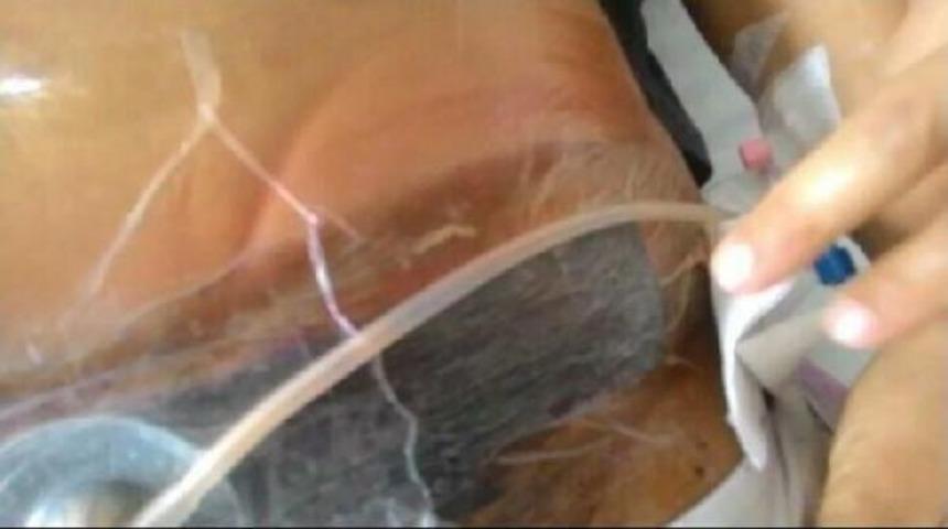 Sezaryenle Doğumda Enfeksiyon Kaptı, 42 G&uuml;nd&uuml;r Bebeğini Kucağına Alamadı