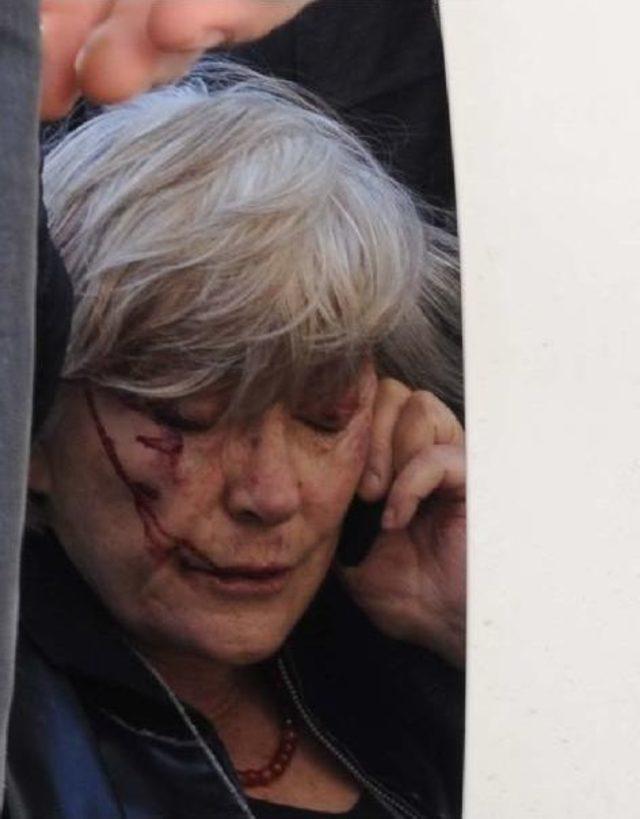 Beşiktaş ta Karşı Şeride Ge&ccedil;ip, Konteynere &Ccedil;arptı 2