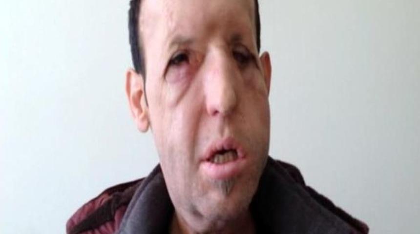 Recep Sert: Sıkıntı Yok Her Şey Yolunda