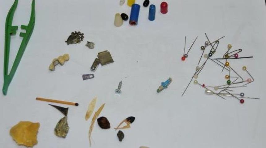 Bu Cisimler Akciğerden &Ccedil;ıkarıldı