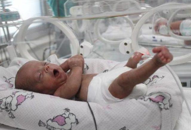 665 Gramlık  parmak Bebek  Yaşama Tutundu 3