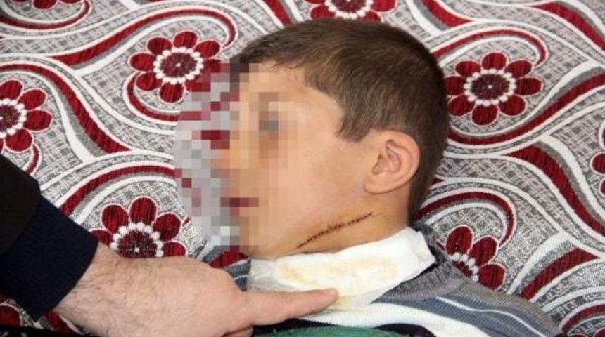 İlkokulda &Ccedil;ocukların Kavgası Kanlı Bitti