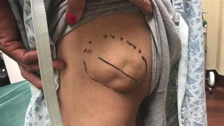 Kalçasından çıkanlar şoke etti! Bu kadarını kimse beklemiyordu G2