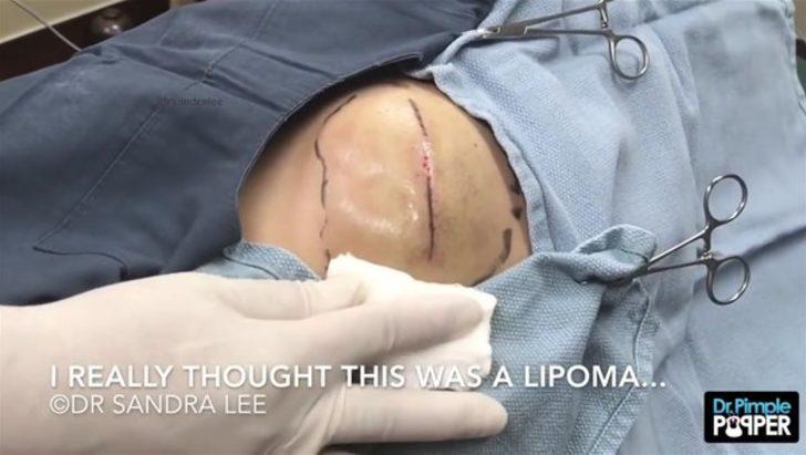 Kalçasından çıkanlar şoke etti! Bu kadarını kimse beklemiyordu G3