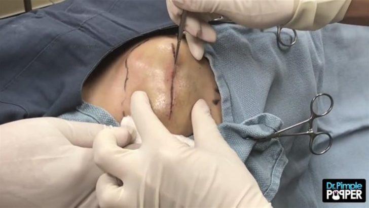 Kalçasından çıkanlar şoke etti! Bu kadarını kimse beklemiyordu G4