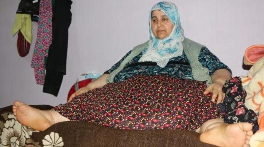 250 Kiloylayataktan Kalkamayan Kadın, G&ouml;zyaşlarıyla Yardım Istedi