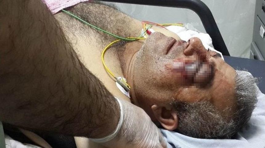 Ciğercilerin Kavgasında 3 Kişi Yaralandı