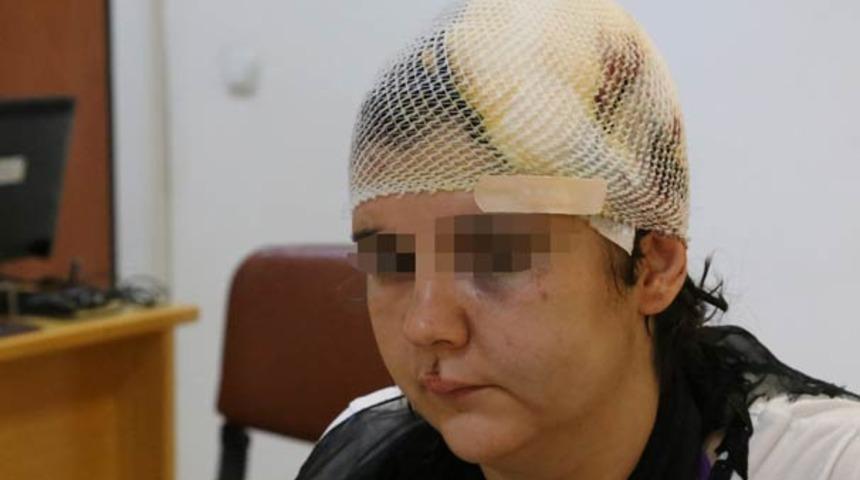 Eşinden boşanmak isteyen kadın taşla darbedildi